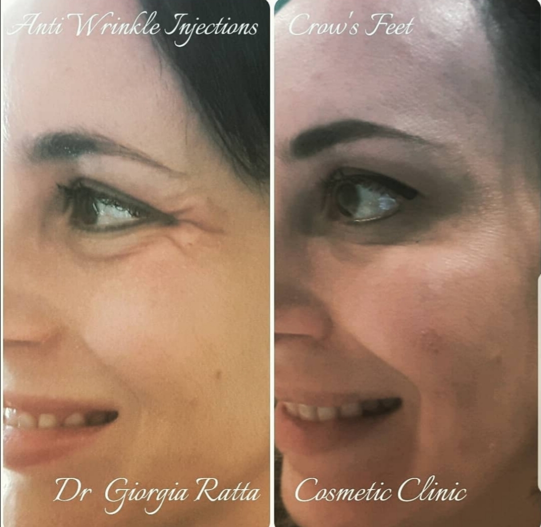 Dr Giorgia Ratta - before and after treatment image