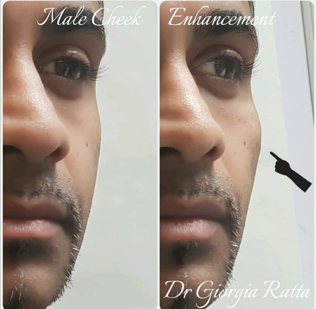 Dr Giorgia Ratta - before and after treatment image