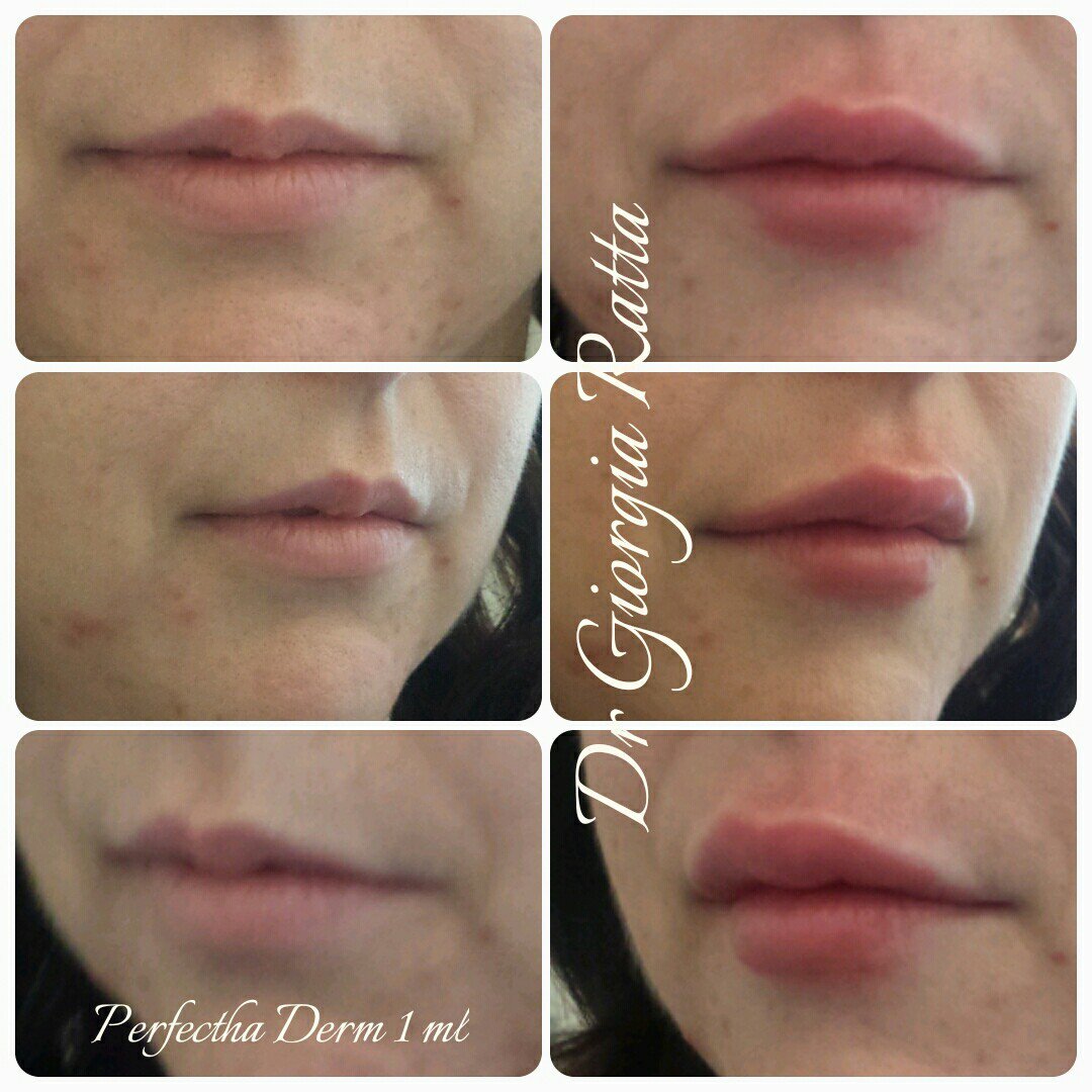 Dr Giorgia Ratta - before and after treatment image