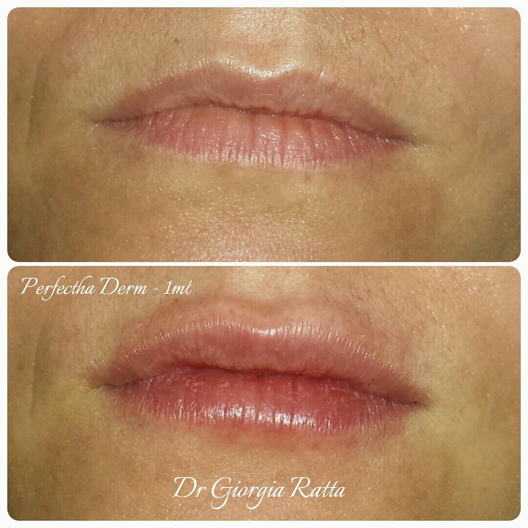 Dr Giorgia Ratta - before and after treatment image