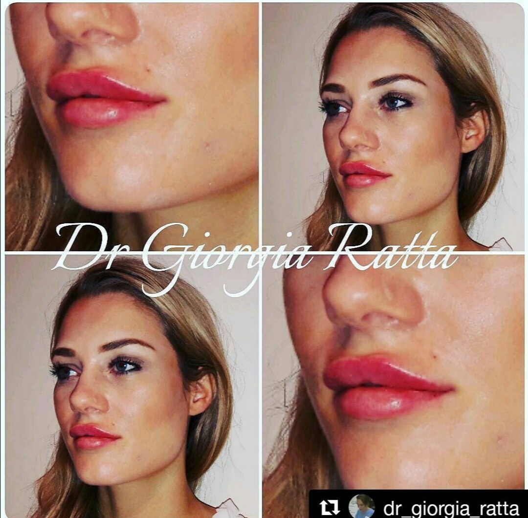 Dr Giorgia Ratta - before and after treatment image