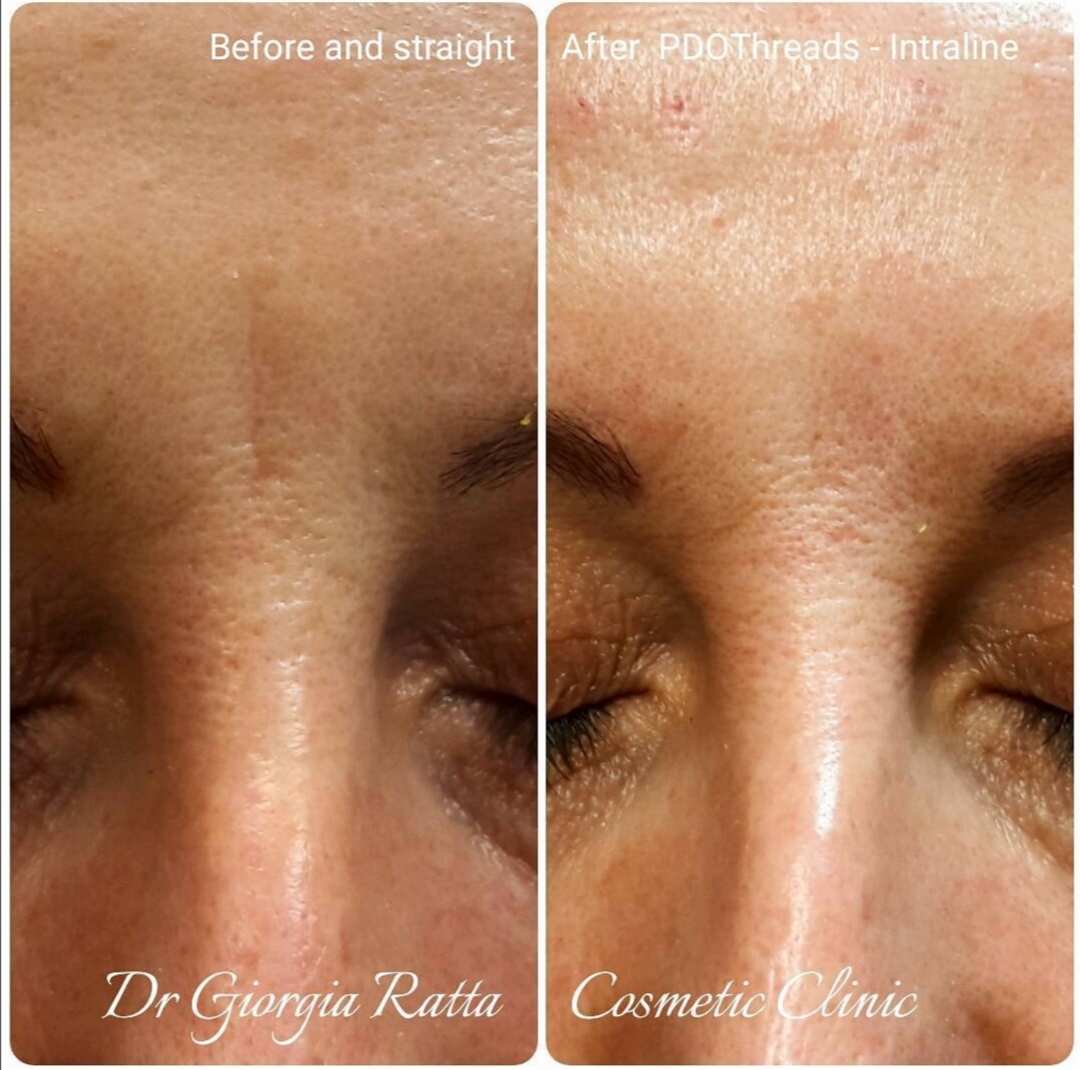 Dr Giorgia Ratta - before and after treatment image
